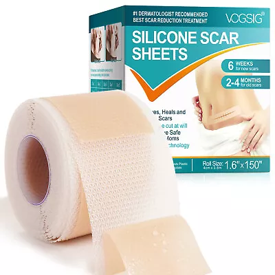 Scar Removal Silicone Tape For Hypertrophic Scars & Keloids 1.6'' X 75''/150  • $27.95