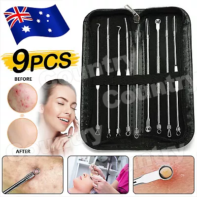 $6.45 • Buy 9Pcs Blackhead Whitehead Pimple Spot Comedone Extractor Remover Popper Tool Kit