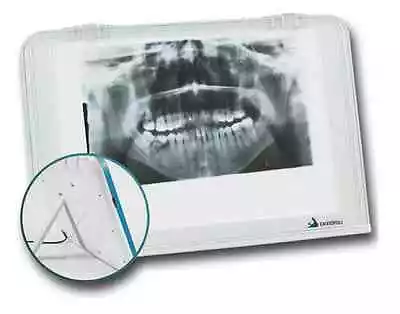 Dental X-ray Film Viewer Diagnostic Imaging LED Light Source Wall Mounting Desk • $119.99