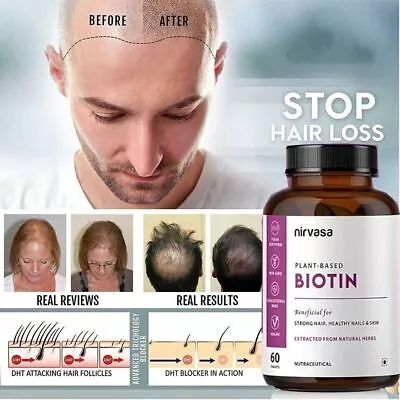 Dht Blocker Hair Fast Growth Herbal Prevent Anti Hair Loss Treatment 60 Tablets • $41.36