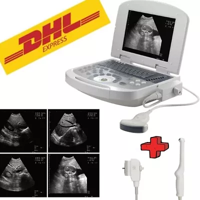 Handheld Digital Ultrasound Machine Medical - Convex Probe+Transvaginal Probe • $2548