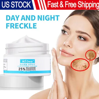 2023 Whitening Freckle Cream Remove Melasma Pigment Melanin Acne Spot Dark Spots • $8.95