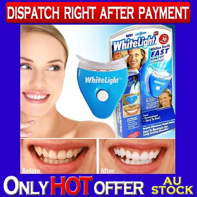 $14.99 • Buy White Light Tooth Whitening Kit System White Teeth Fast Light Technology