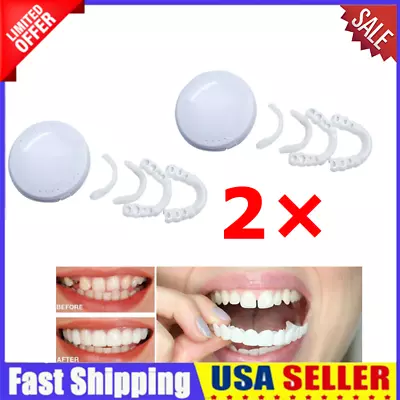 Fake Teeth Simulation Braces Durable Tooth Cover Healthy Creative Smiling Veneer • $8.10