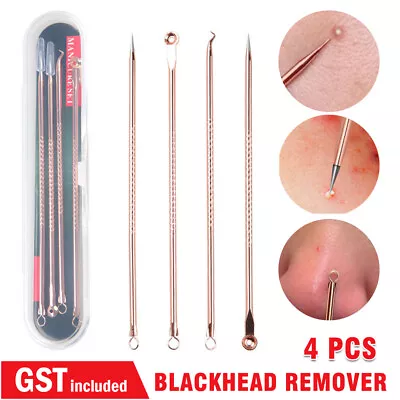 $4.22 • Buy 4pcs Blackhead Remover Tool Pimple Popper Pore Blemish Comedone Acne Cleaner