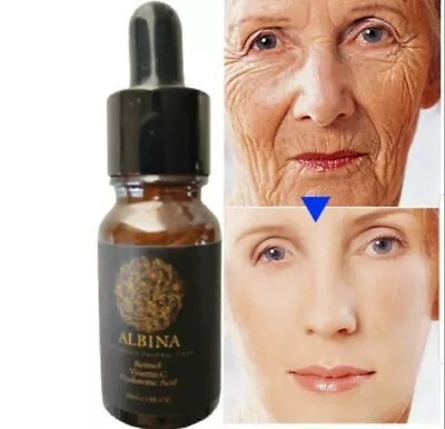 Retinol 2.5% Vitamin A C E & Hyaluronic Acid Face Serum Anti Aging Wrinkles • £3.99