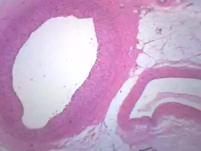 Human Artery & Vein Prepared Microscope Slide - 75x25mm - Eisco Labs • $7.99
