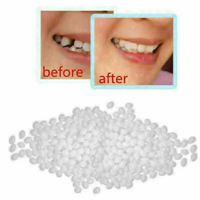 10g~100g Temporary Tooth Repair Kit Fix Broken Teeth And Fills Gaps Non Toxic • £3.11