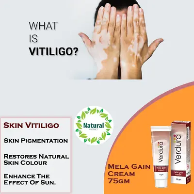 DEPIGMENTED / VITILIGO SKIN Treatment - MELA GAIN CREAM 75gm  REPIGMENTATION  • $29.99