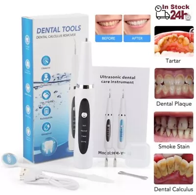 $17.45 • Buy Electric Dental Scaler Ultrasonic Tartar Calculus Plaque Remover Teeth Cleaner