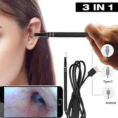 Ear Otoscope Megapixels Scope Inspection Camera USB Digital Endoscope Earwax • $20.88