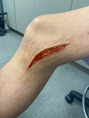 The Skin Wound 8 | Silicone Prosthetic | SFX Make Up • £6.99