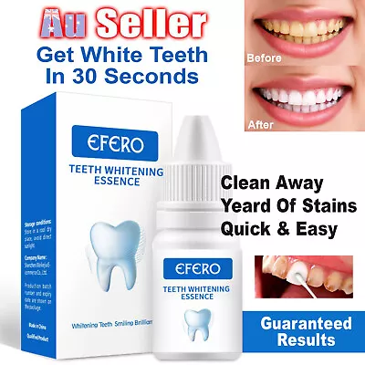 $12.65 • Buy Instant Tooth Whitening Kit White Teeth Clean Gel UV Bleach Dental Strength AU