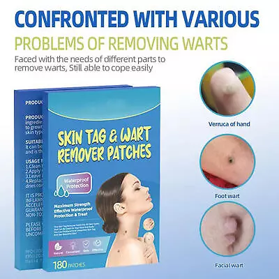 180pcs Skin Tag Remover Patches Quick Effective Mole Wart Removal Pad Sticker  • $8.36