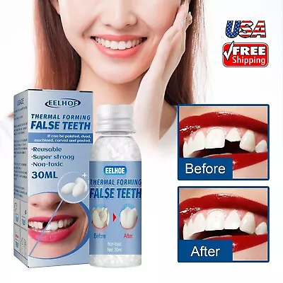 Resin False Teeth Solid Glue Temporary Tooth Gap Filler Tooth Repair Moldable US • $7.63