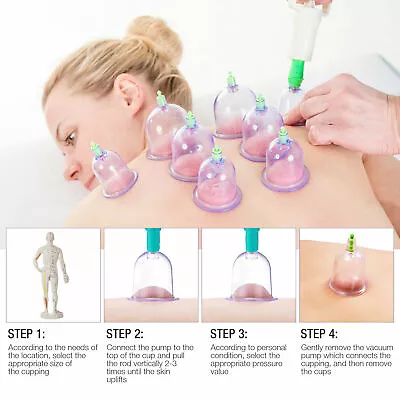 12 Cups Professional Medical Chinese Vacuum Cupping Body Massage Therapy Healthy • $11.99