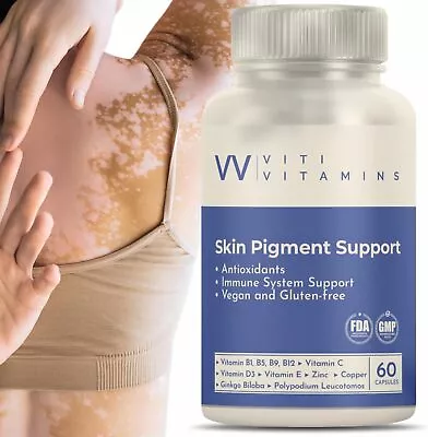 Advanced Vitiligo Supplement For Skin Pigmentation Support| 1 Month Supply • $65.98