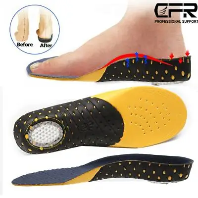 Orthotic Shoe Insoles High Arch Support Inserts Plantar Fasciitis Flat Feet Back • $7.49