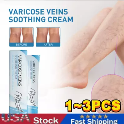 Raura Varicose Veins Cream Raura Varicose Veins Treatment Cream For Legs • $9.99