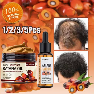 5/3X Natural Batana Oil For Hair Growth Anti Hair Loss Treatments For Men&Women • £8.95