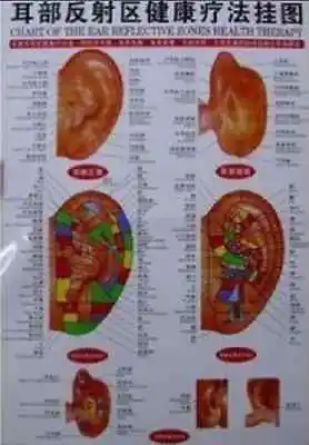 Acupuncture English & Chinese Huge Ear Chart 25 X18   (US Seller) • $8.99