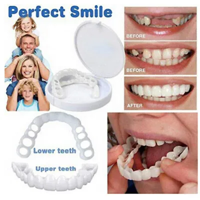 Snap On Upper＆Bottom Set False Teeth Dental Veneers Denture Tooth Cover Silicone • $6.99