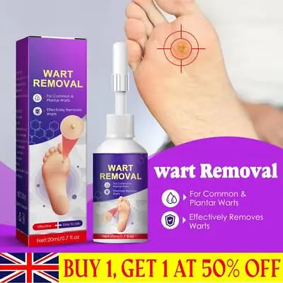 Foot Corn Removal Liquid Painless Treatment Genital Warts Calluses -UK • £5.15
