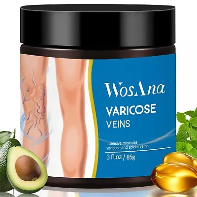 Varicose Veins Cream Treatment For Leg Varicose Veins And Spider Veins Ex 11/26 • $11.99