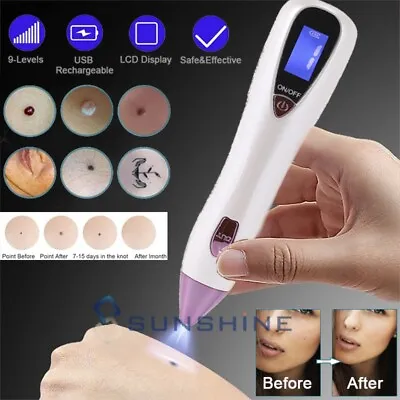 $23.67 • Buy Painless Electric Mole Removal Pen Laser Plasma Dark Spot Remover Skin Wart Tag 