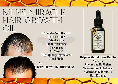 Mens Miracle Hair Growth Oil • $21.99