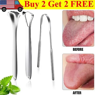 3Pcs Tongue Scrapers For Adults Kids Medical Grade Metal Tongue Scraper Cleaner • $6.32