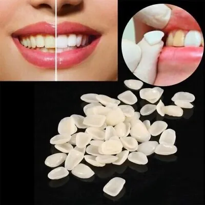 Dental Temporary Crown Veneers For Anterior Front Teeth Whitening 70Pcs • $7.83