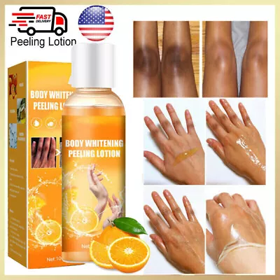 $9.95 • Buy 100ml Body Dark Skin Whitening Cream Knuckle Bleaching Peeling Dark Spot Removal
