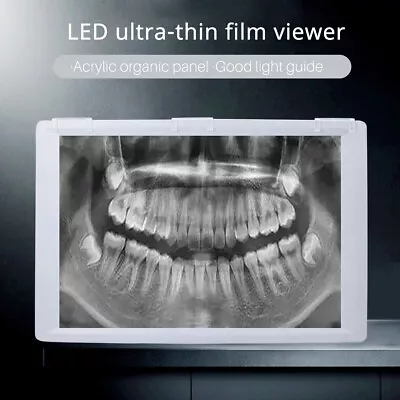 10W Dental Panorama X-Ray Film Viewer Illuminator Light Box LED Light Panel • $85.49