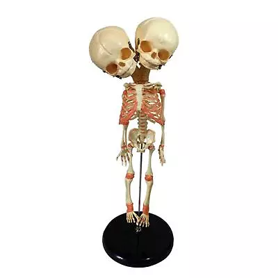 Baby Deformed Head Skull Model With Base Baby Skeleton Model For Research • £38.39