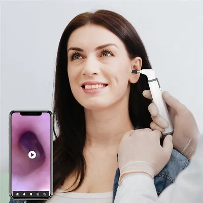 TESLONG 5-in-1 3.9mm Wifi Otoscope For IPhone / IPad / Android / Tablet • $38.38