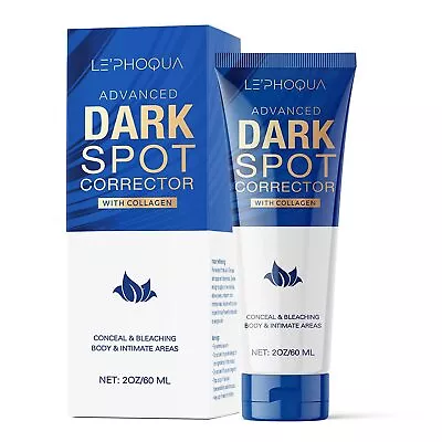 Dark Spot Corrector Cream-Melasma Hyperpigmentation BlemishSun & Brown Spots • $17.99