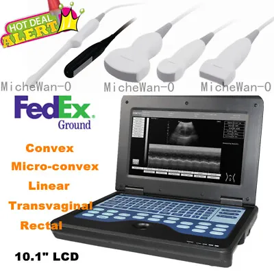 Human/VET Ultrasound Scanner Portable Laptop Machine Digital Probe Factory Sale • $400