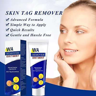 STRONG SKIN TAG REMOVER Cream NATURAL TREATMENT MOLES WARTS And TAGS • £7.50