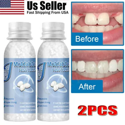 Resin False Teeth Solid Glue Temporary Tooth Repair Moldable Teeth Gap Denture • $9.95