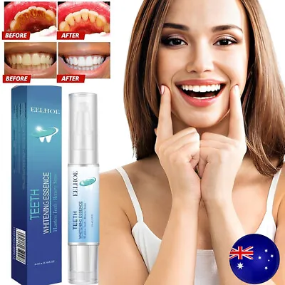 $15.19 • Buy LANTHOME Teeth Whitening Essence, Teeth Whitening Pen, Teeth Whitening Kit 2023