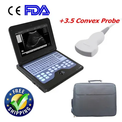 CE Approved Portable Laptop Machine Digital Ultrasound Scanner+3.5M Convex Probe • £1112