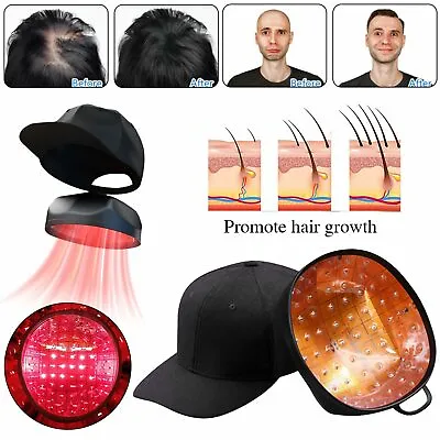 $135.36 • Buy 650nm Led Laser Hair Growth Cap Hat Hair Loss Therapy Hair Regrowth Growth Cap
