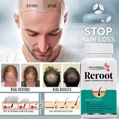 Dht Blocker Hair Fast Growth Herbal Pills Prevent Anti Loss Stimulate 60 Caps Fs • $38.06