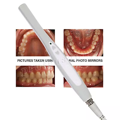 MD740 Dental Intraoral Camera USB Digital Imaging Intra Oral NEW • $89.99