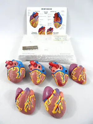 Nasco Mini Heart Set Of 3 Models Medical Teaching Tool • $116.10