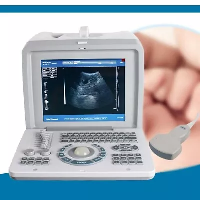 10  Full Digital Laptop Ultrasound Scanner Machine + 3.5MHz Convex Probes 3D • $999