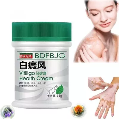 Natural Vitiligo Care Cream Vitiligo Treatment Cream  Women Men • £5.28