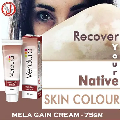 Vitiligo Treatment Natural Skin Repigmentation Therapy - Mela Gain Cream 75gm • $29.99