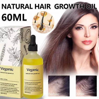 Natural Hair Growth Oil Veganic Natural Hair Growth Oil Hair Care 60ml UK~ • £9.99